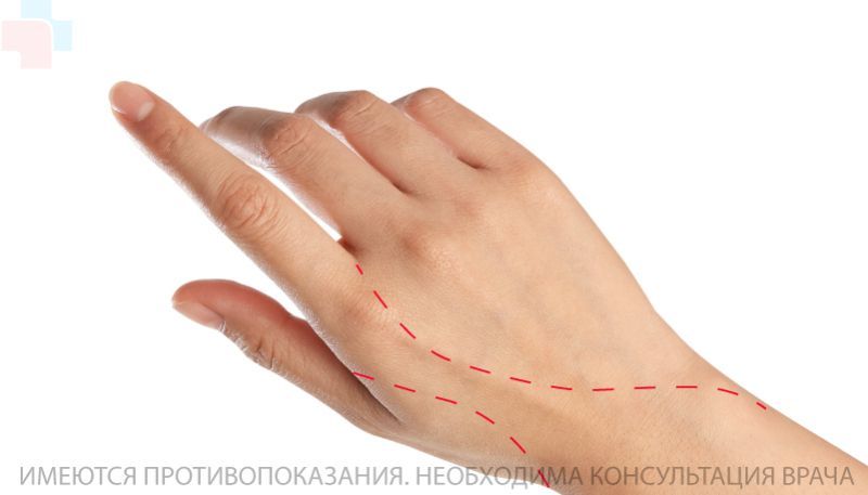 Хирургия подкожных новообразований